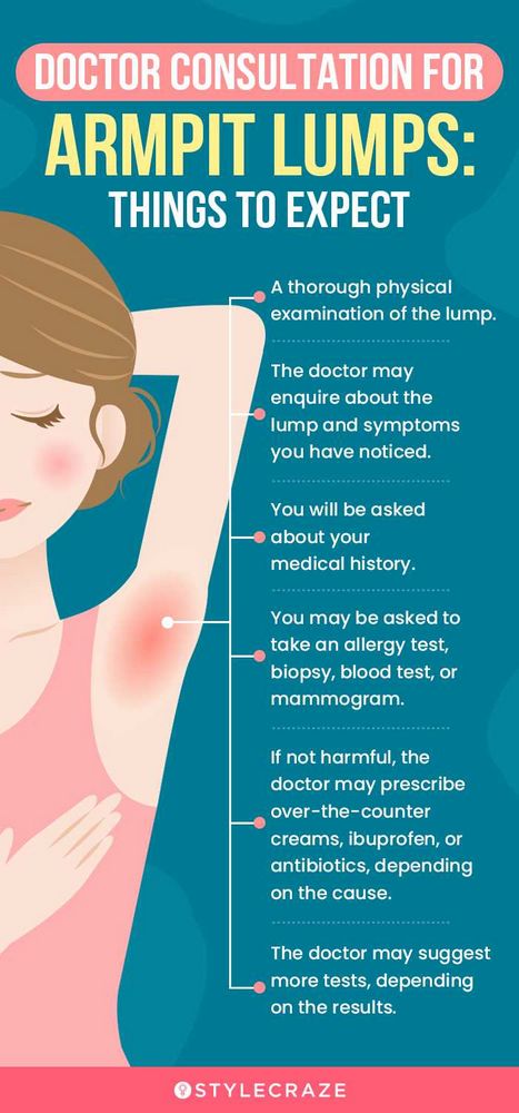 Top Tips And Remedies For Effective Armpit Cyst Treatment 