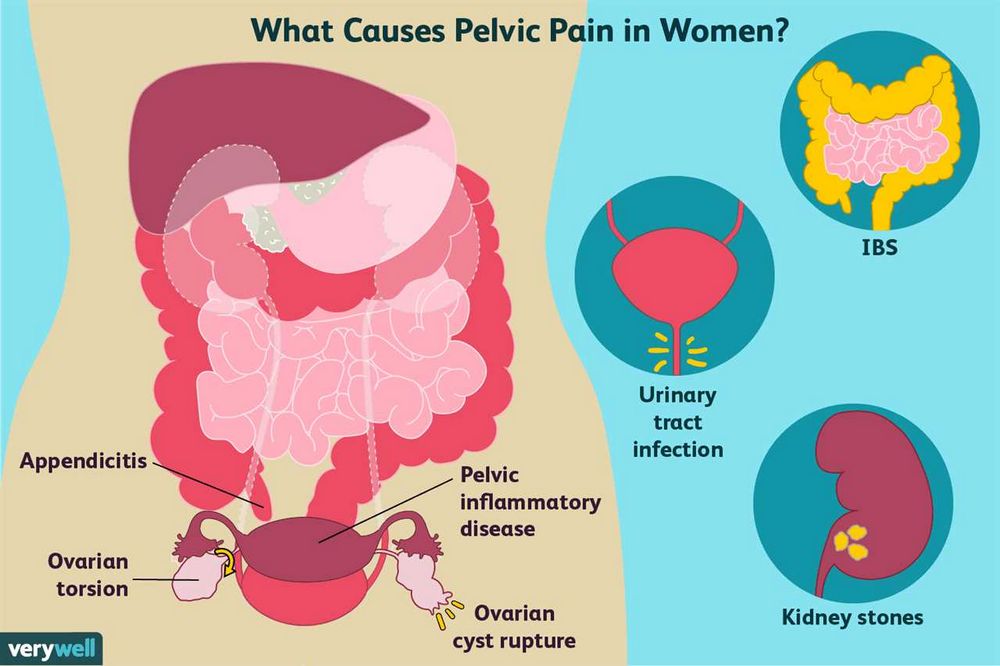 Sharp Pain in Vag: Causes, Symptoms, and Treatment (Not Pregnant)