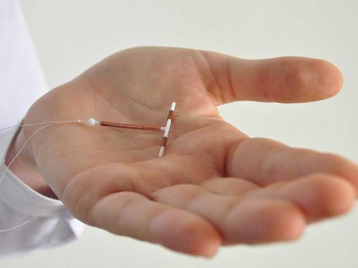 Exploring the Benefits of IUDs in Treating Endometriosis