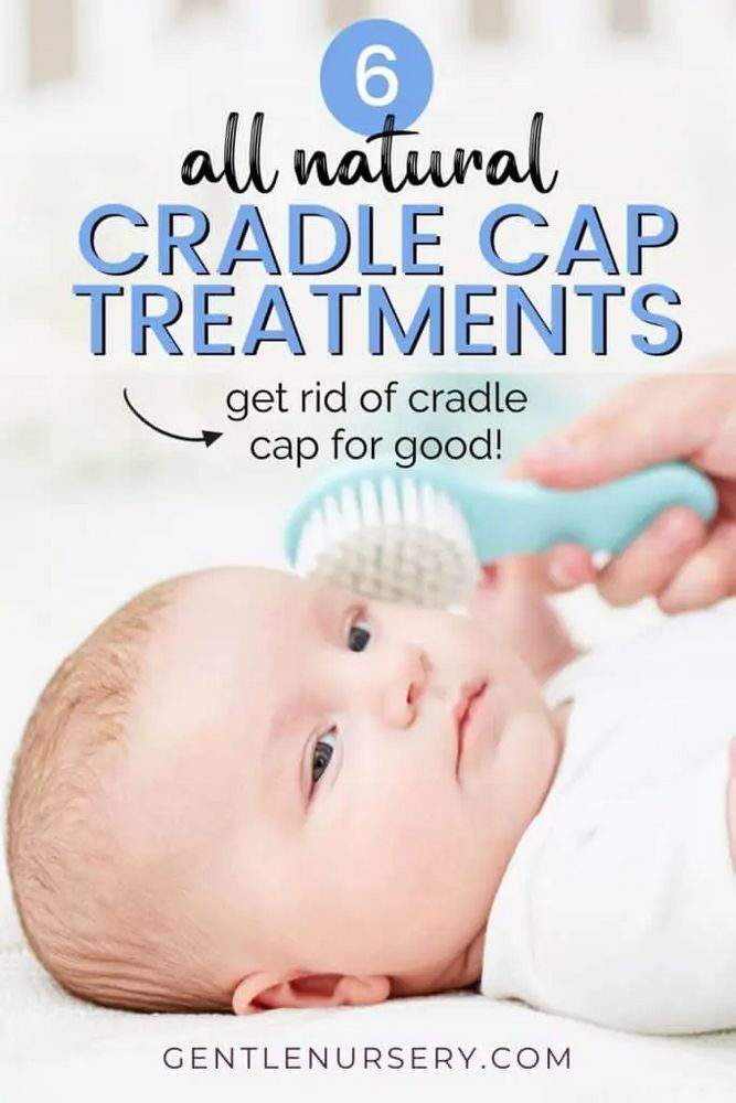 Natural Remedies for Baby's Scalp Condition: Olive Oil for Cradle Cap