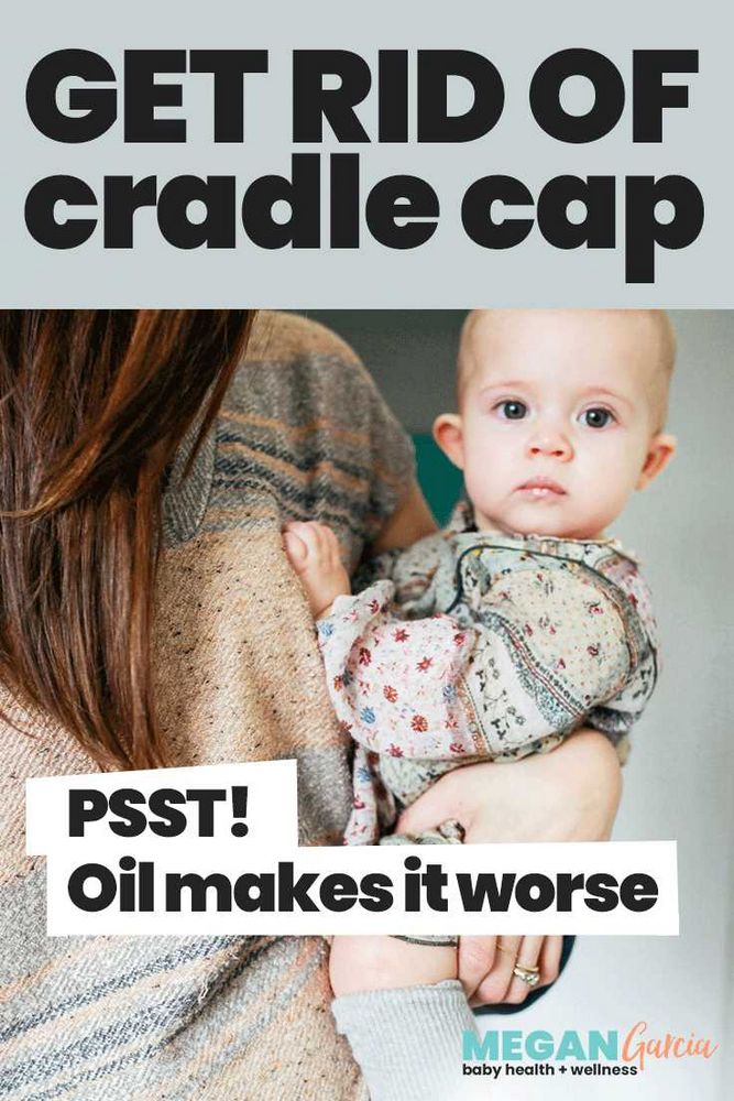 Natural Remedies for Baby's Scalp Condition: Olive Oil for Cradle Cap