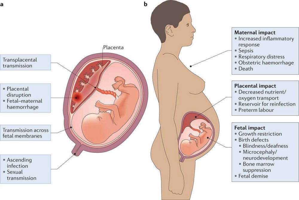 Bone Marrow Pregnancy: Causes, Symptoms, and Treatment