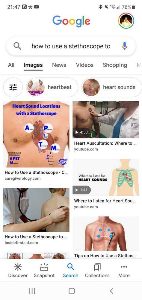 Can You Hear a Baby's Heartbeat with a Stethoscope? Find Out Here