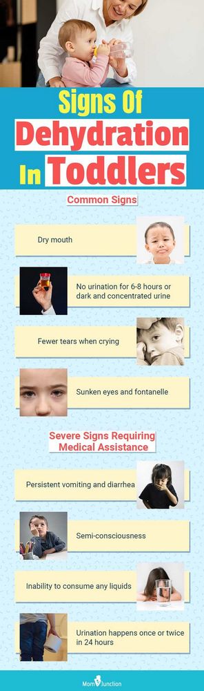 Sunken Eyes Dehydration: Causes, Symptoms, and Treatment