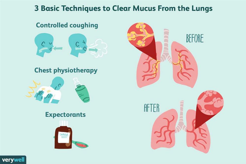 Throwing up mucus: Causes, Symptoms, and Treatment
