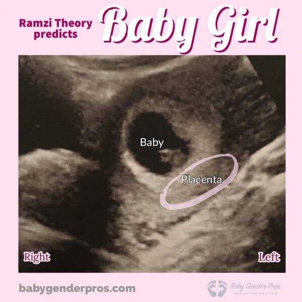 Understanding the Ramzi Theory: A Guide to Predicting Baby's Gender